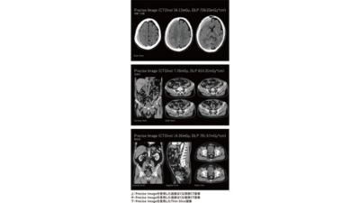 上：Precise Imageを使用した低被ばくな頭部CT画像 
中：Precise Imageを使用した低被ばくな腹部CT画像 
下：Precise Imageを使用したThin Slice画像
