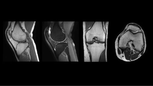 Knee
