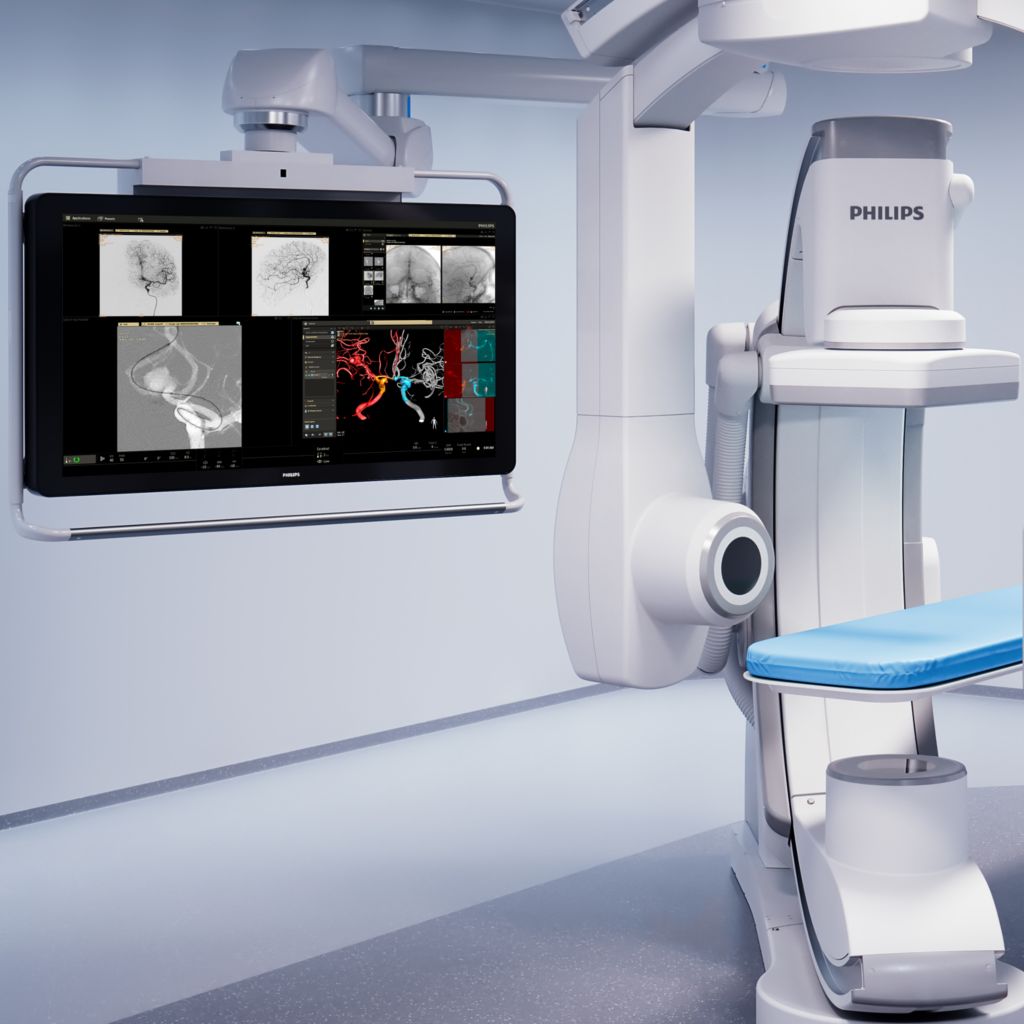 3D fusion imaging of 3D-RA and CBCT datasets during the procedure to support assessment and diagnosis.