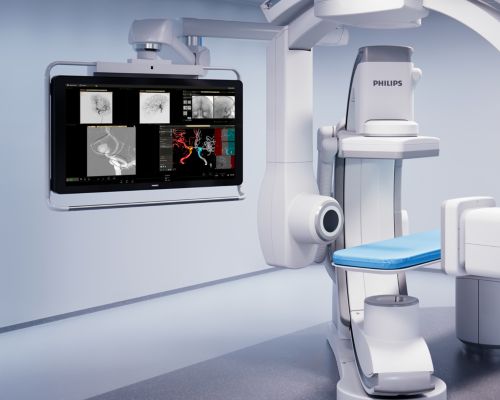 SmartCT Vaso report