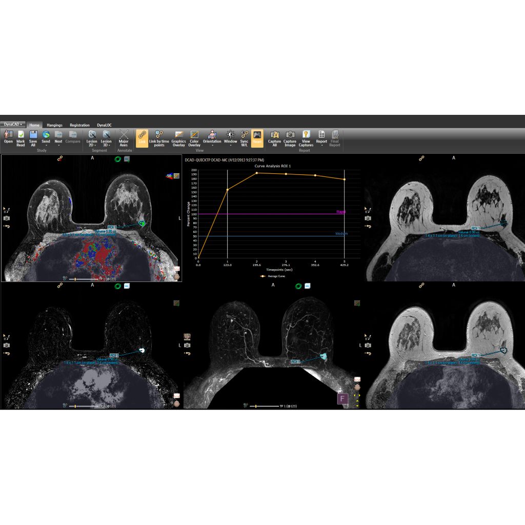 Customizable displays of post-processed data