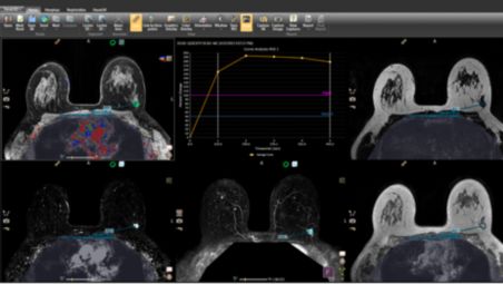 Customizable displays of post-processed data