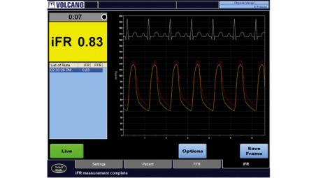 iFR modality simplifies workflow