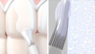 Breakthrough two-layer technology