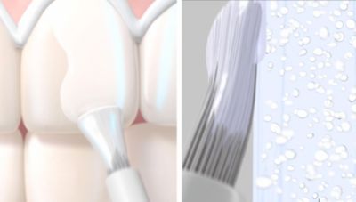 Breakthrough two-layer technology