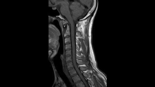 Sagittal T1w TSE 