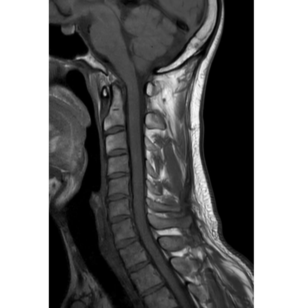 Sagittal T1w TSE 