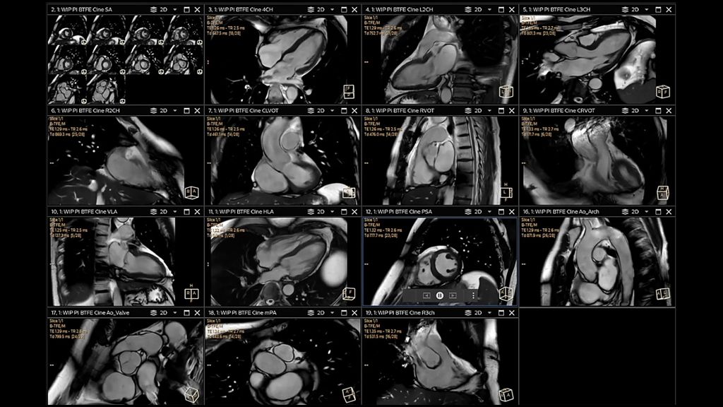 14 basic and advanced cardiac views
