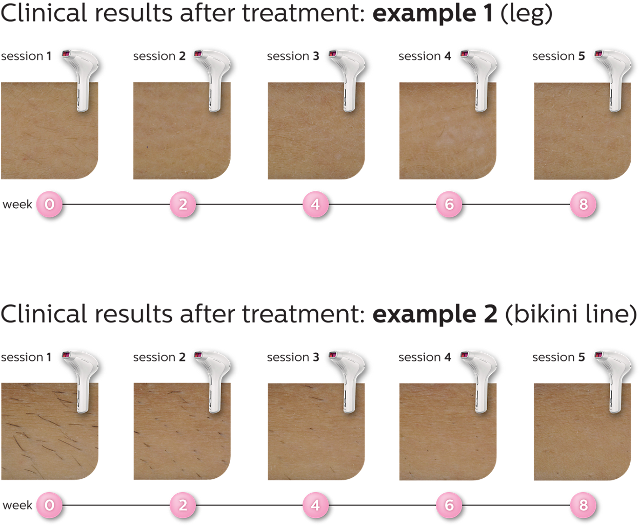 Lumea Prestige ルメア プレステージ SC2009/70 | Philips Lumea Prestige ルメア プレステージ SC2009/70 | Philips