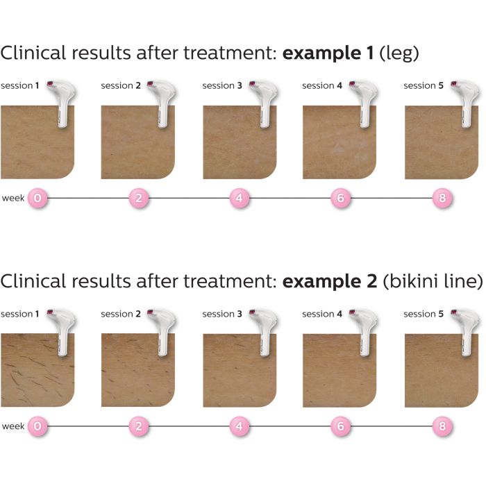 SC2009/70フィリップス　ルメア　プレステージ Lumea Prestige ルメア プレステージ SC2009/70 | Philips