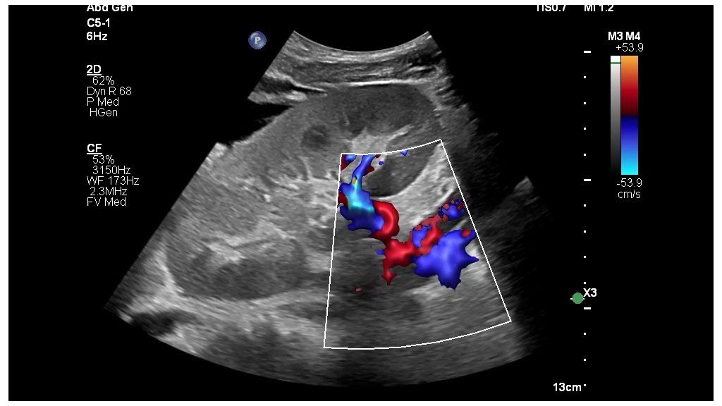 flow viewer ultrasound scan