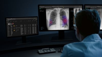 Radiologist reviewing an x-ray image