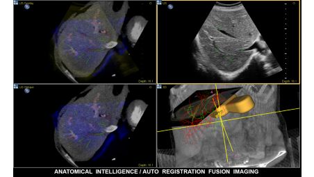 Fully integrated multi-modality image fusion (US/CT/MR/PET)