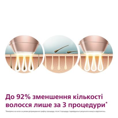 Philips Фотоепілятор Lumea від Philips