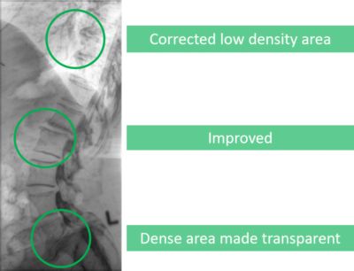 Multi scale image enhancement