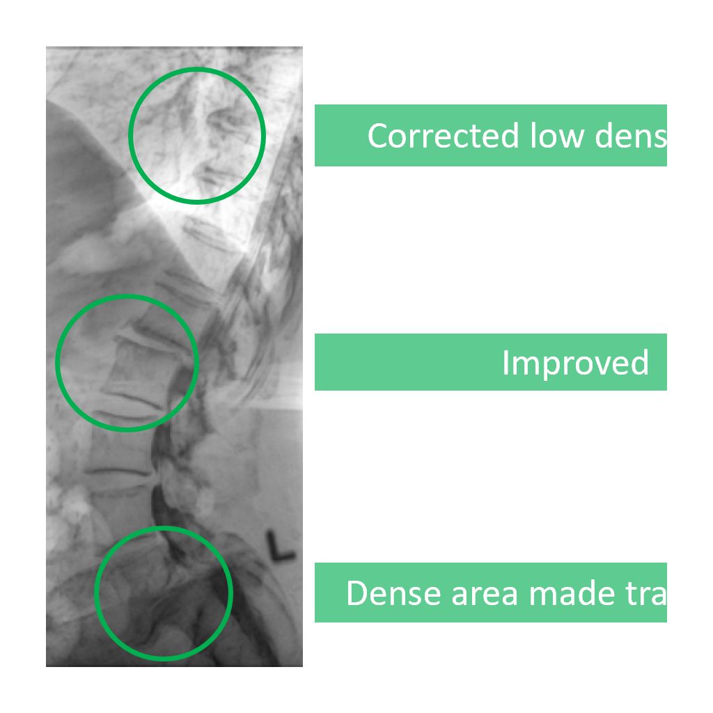 Multi scale image enhancement