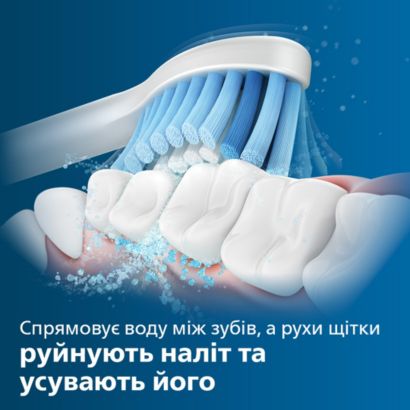 Sonicare S Sensitive
