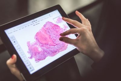 Digital pathology slide reviewed on tablet device