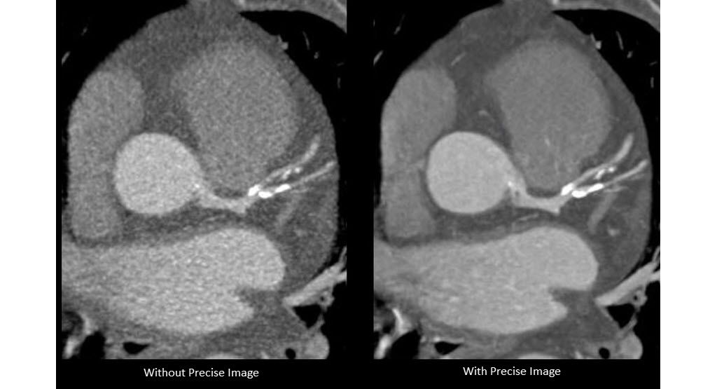 Advance your cardiac imaging capabilities