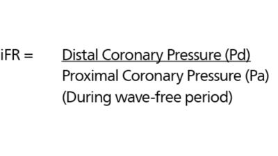 Image showing iFR equation