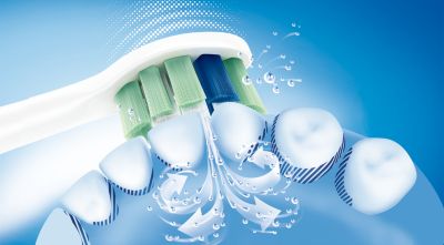 La acción de limpieza dinámica de Sonicare conduce el fluido entre los dientes