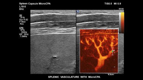 Spenic vasculature with MicroCPA