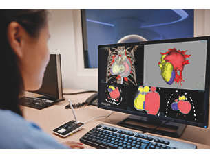 IntelliSpace Portal Экспертный анализ медицинских изображений