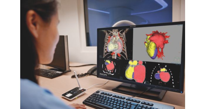 IntelliSpace Portal 10