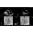 Case example EchoNavigator: transseptal puncture thumbnail