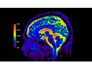 Multi Nuclei - Brain Seamless integration of Multi Nuclei