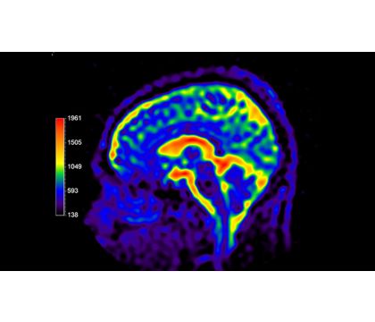 Multi Nuclei Brain
