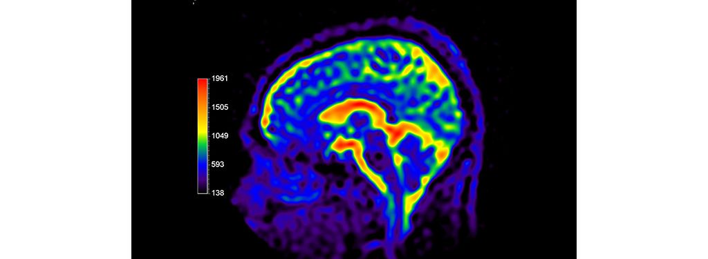 Multi Nuclei Brain