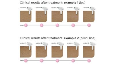 Effortlessly effective