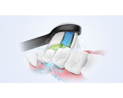 Advanced Sonicare Technology