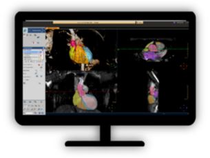 MR Cardiac Whole Heart​ Detailed 3D visualization of the segmented heart