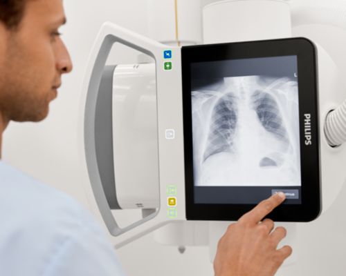 Target and deviation index X-ray