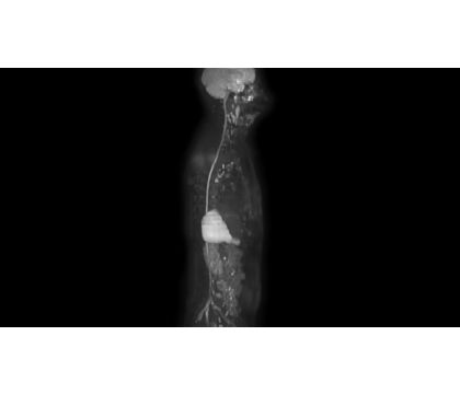 Diffusion Excellence Pack Whole body