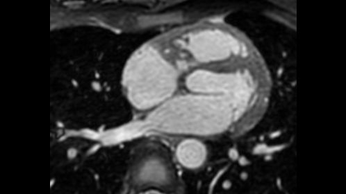 Non-selective 3D bFFE


