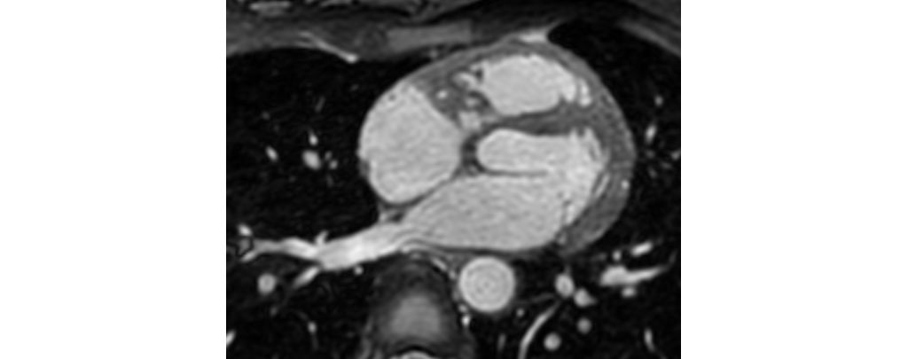 Non-selective 3D bFFE

