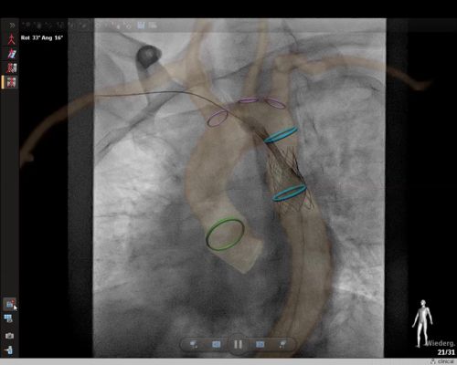 Live X-ray image