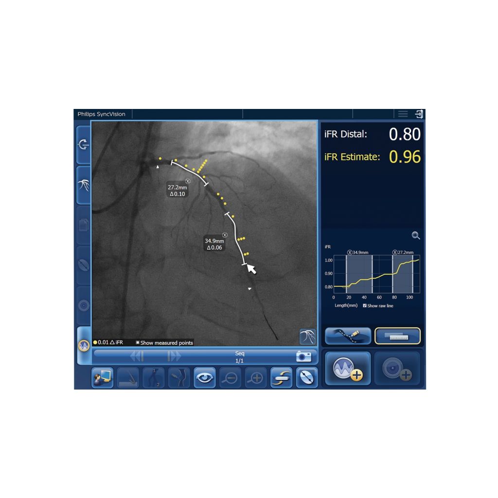 iFR has co-registration