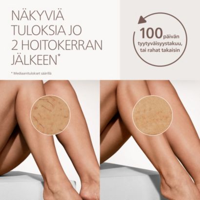 Philips Lumea IPL 8000