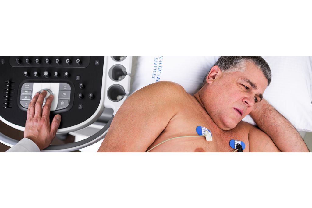 Philips EPIQ ultrasound machine product product in use photograph. 