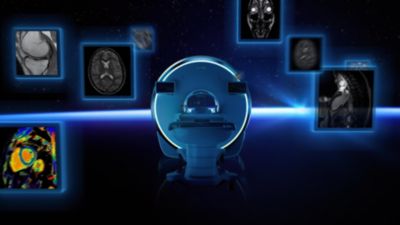 Philips Horizon: Technologischer Durchbruch mit erstem heliumfreien 3.0T MRT