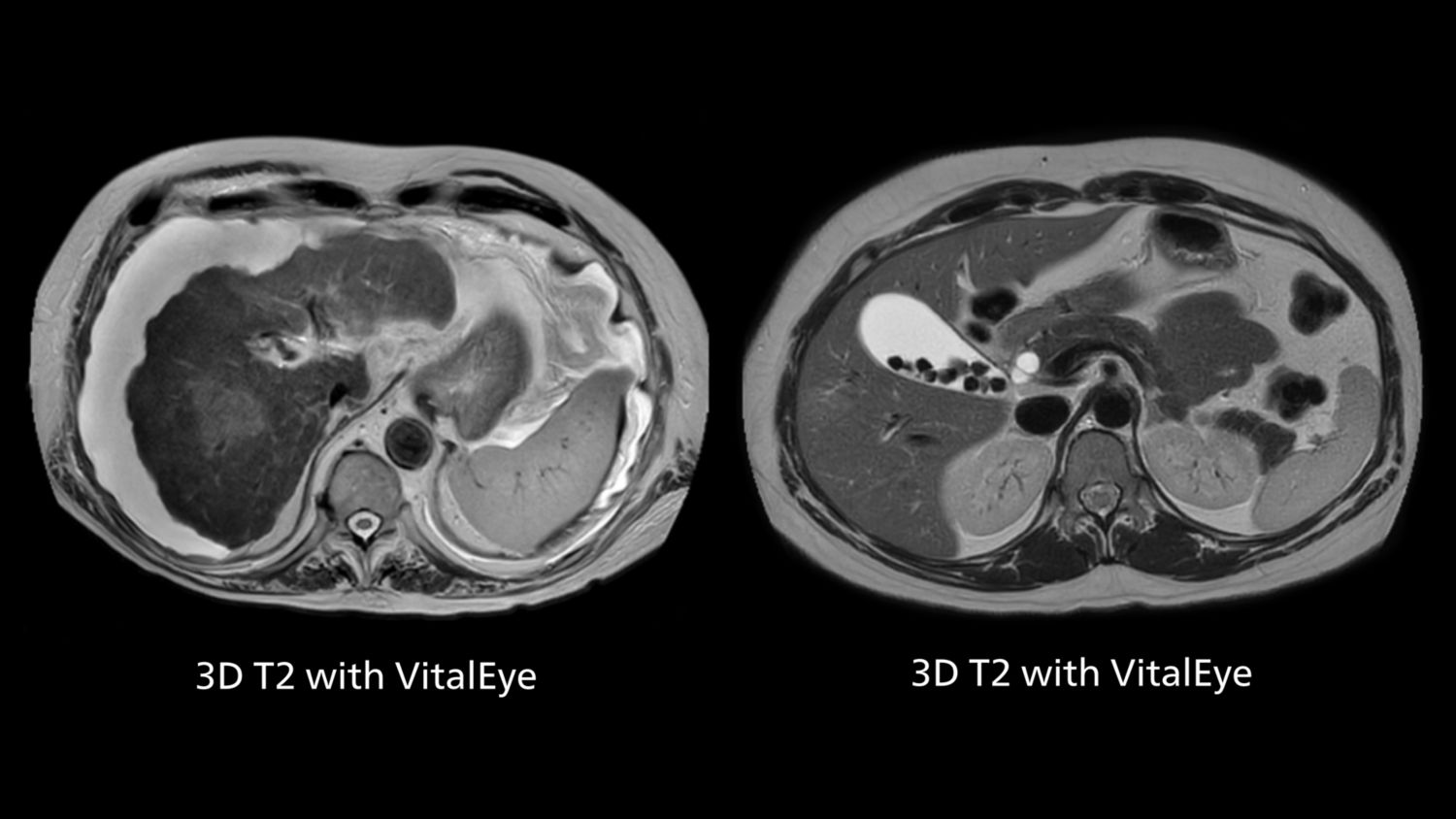 Scan with VitalEye