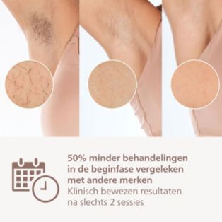 Lumea IPL 8000 Series IPL-ontharingsapparaat met SenseIQ