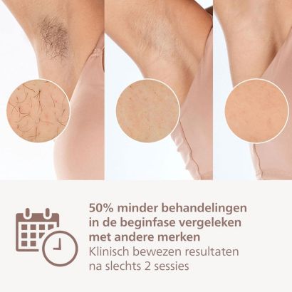 Philips Lumea IPL Series 9000