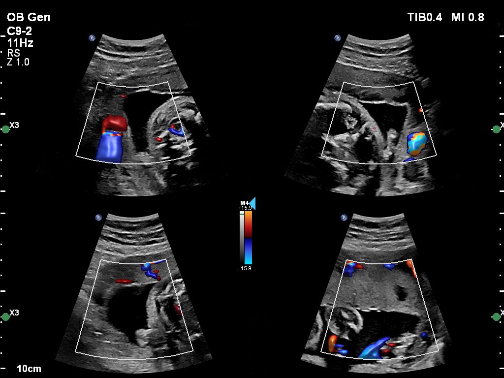 C9-2 OB Gen Affiniti VM14 Quad Color Measurements Fixed