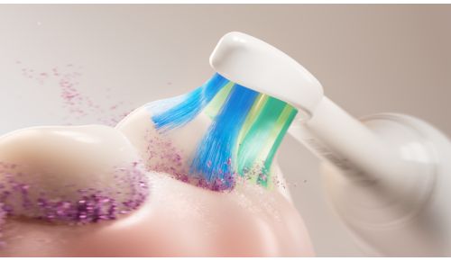 Tar försiktigt bort upp till 3 gånger mer plack*