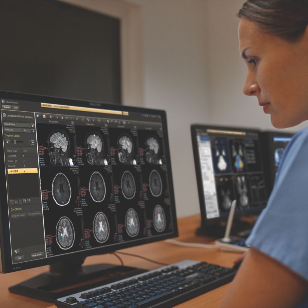 Philips IntelliSpace Portal